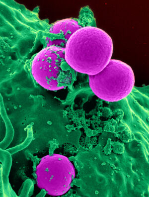 Staphylococcus aureus pohledem skenovacího elektronového mikroskopu
