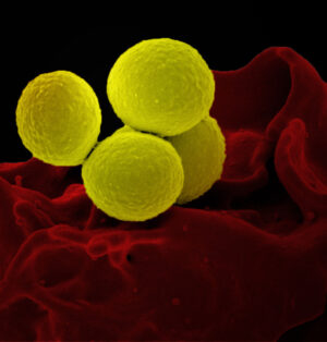Staphylococcus aureus pohledem skenovacího elektronového mikroskopu