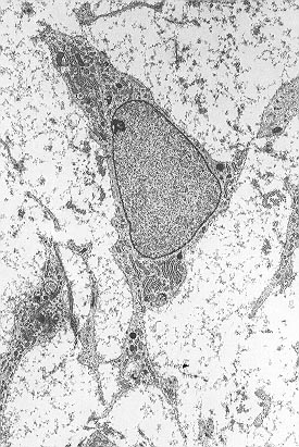Mezenchymální kmenová buňka pod transmisním elektronovým mikroskopem