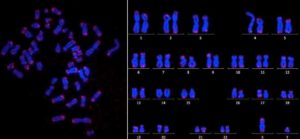 Chromozomy a jejich telomery