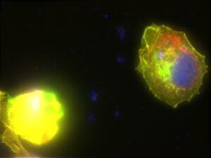 Studium rakovinotvorných buněk na ISS