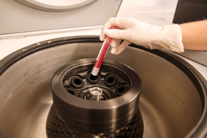 Laboratorní analýza.