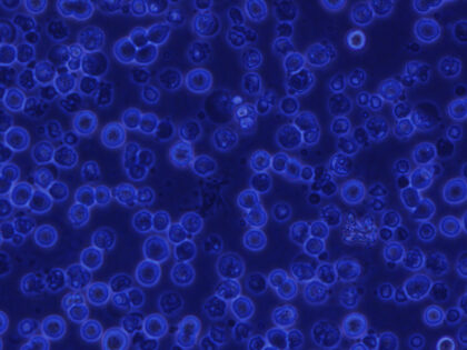 Primordiální zárodečné buňky kura domácího v in vitro kultuře.